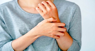 Sedef Hastalığı İlaçla Tedavi Edilebiliyor